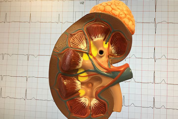 Urinary Tract Infection Treatment Best Urinary Tract Infection Treatment Doctor in Latur